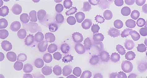  Babesia - Ein winziger Parasit mit riesigem Einfluss auf die Gesundheit von Säugetieren!